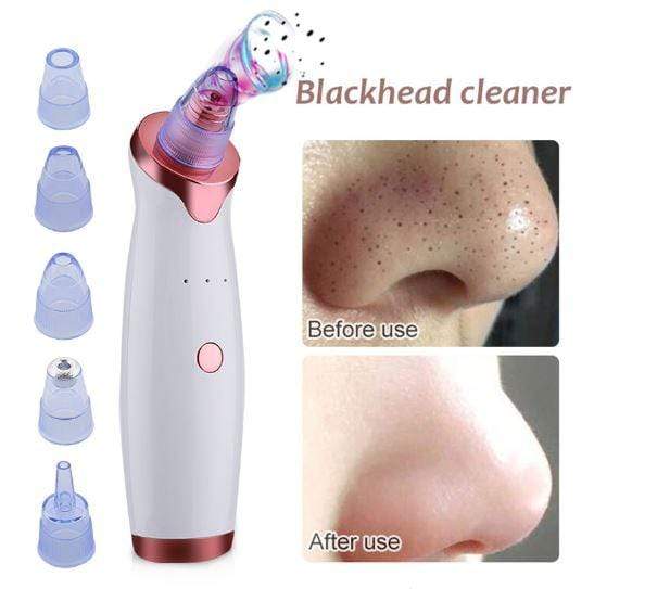 Blackhead Remover Pore Cleaner Vacuum Suction Tool